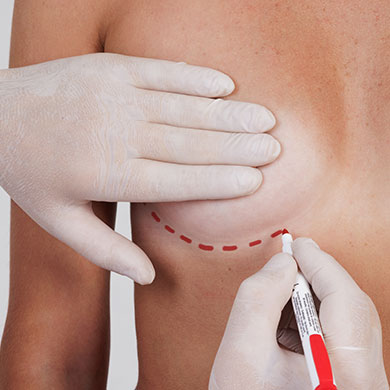 breast-surgery Breast Surgery